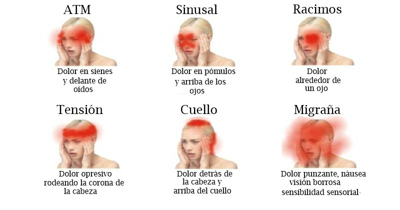 Qu Indican Esos Molestos Dolores De Cabeza Te Mostraremos Las