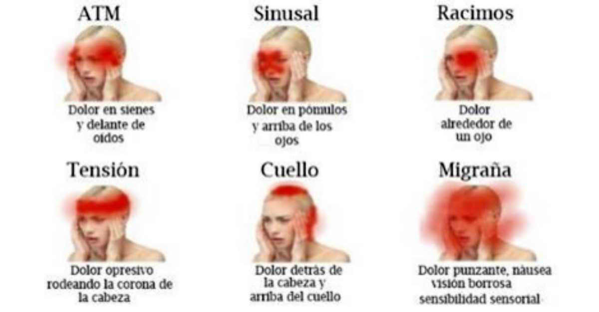 ¿Qué Indican Esos Molestos Dolores De Cabeza? Te Mostraremos Las