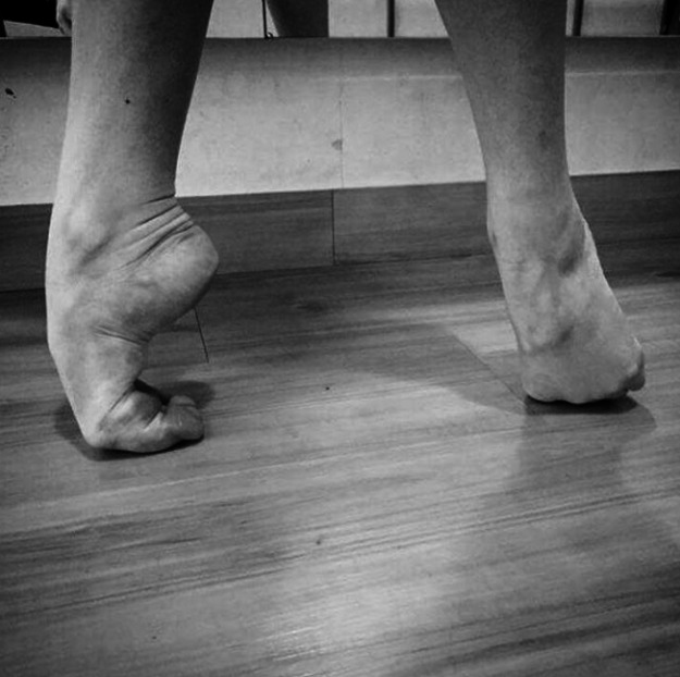 bailarinas foto15