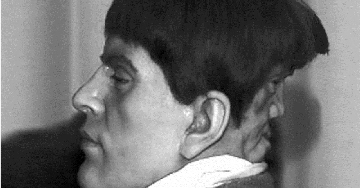 La Espeluznante Historia Del Hombre Que Tenía Una Cara En La Nuca Que Le Hizo Perder La Razón La Espeluznante Historia Del Hombre Que Tenía Una Cara En La Nuca Que Le Hizo Perder La Razón