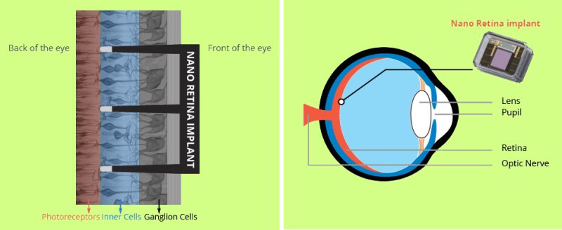 bioretina-2