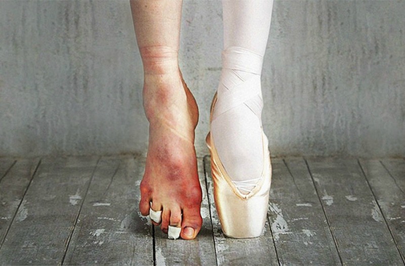 Ballet foto 2