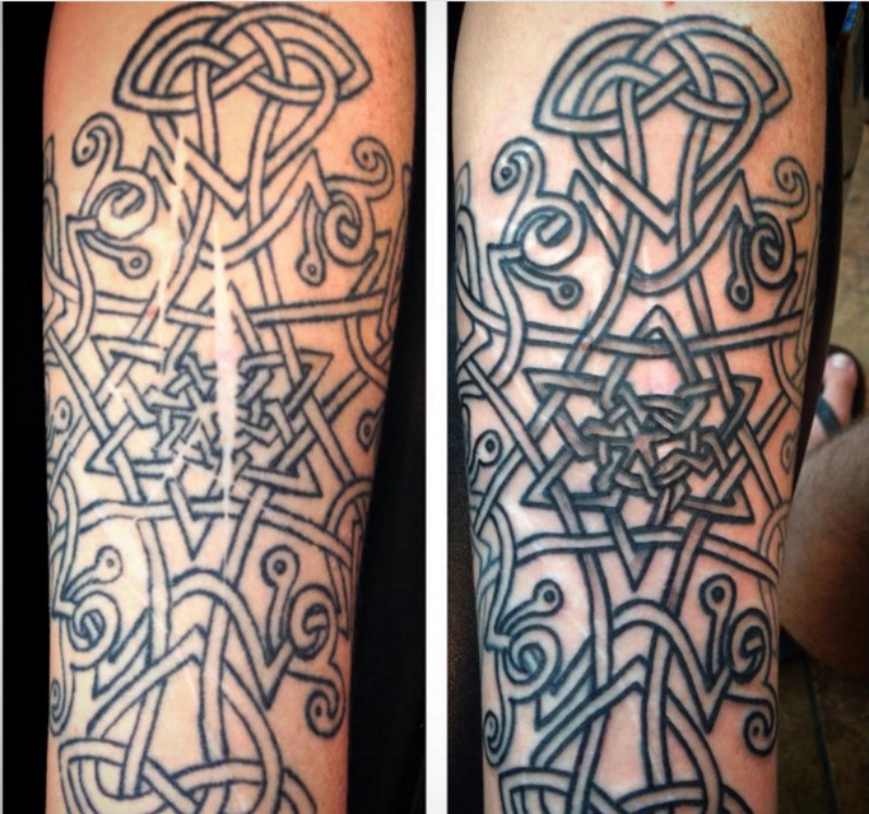 Tatuaje y cicatrices foto 4