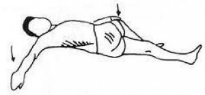 Ejercicios para el dolor de espalda 3