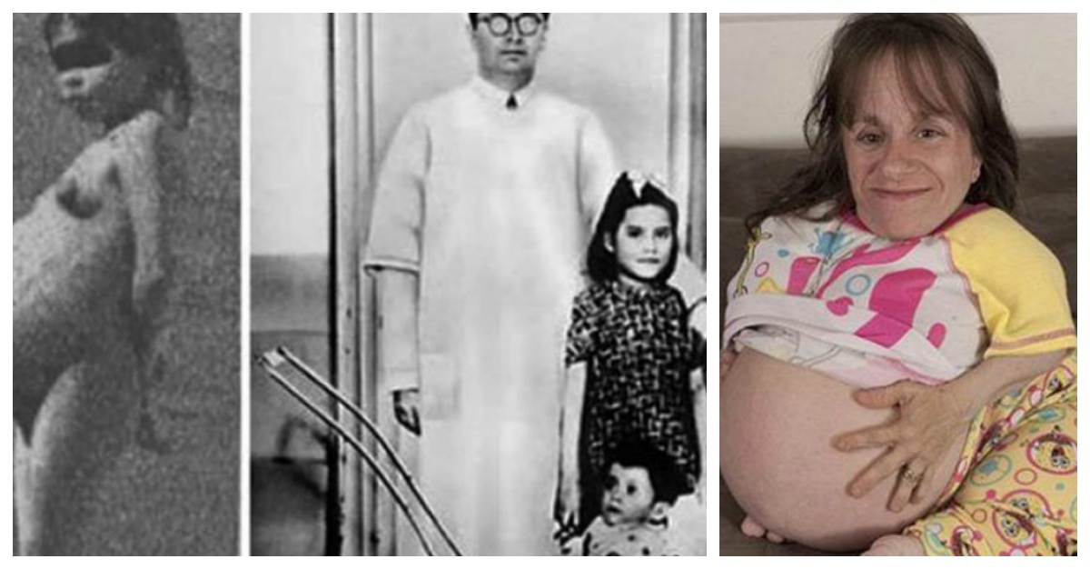 Estos Son Los 7 Embarazos Más